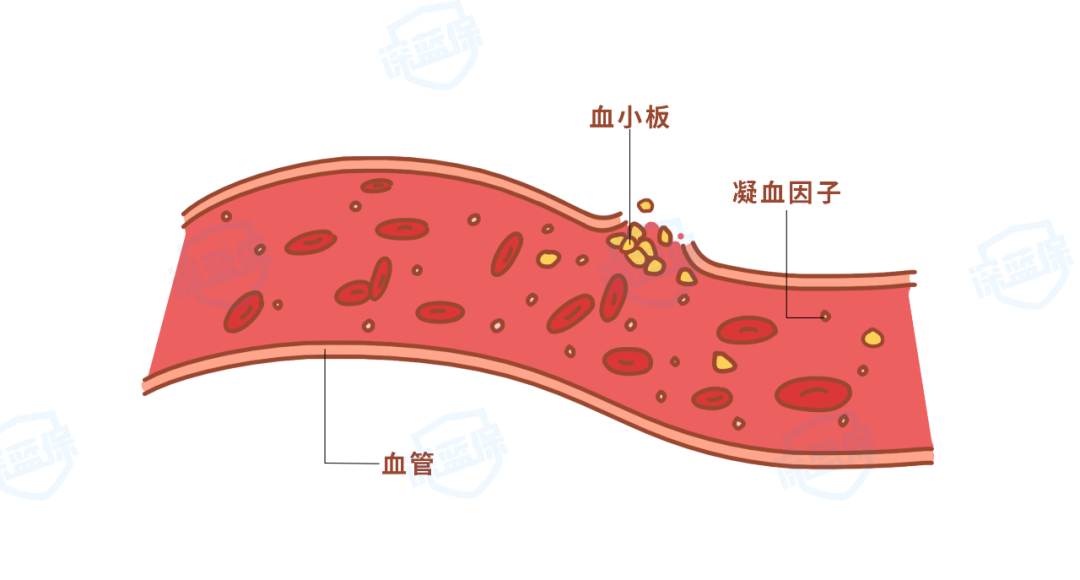 遗传性疾病，重疾险也能赔？